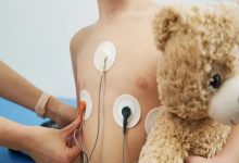 Arrhythmia heart flutter