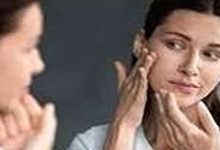 When dry skin isn’t just dryness