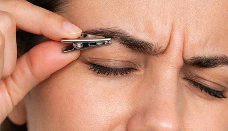 The eyebrow clip migraine trend