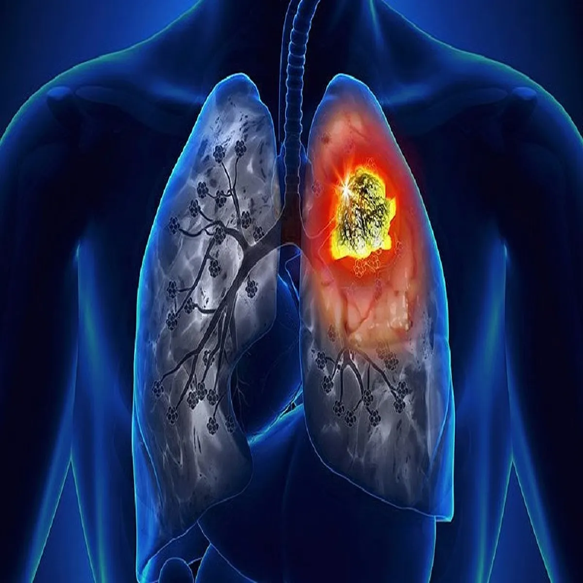 Cancer over 000 cases reported jammu