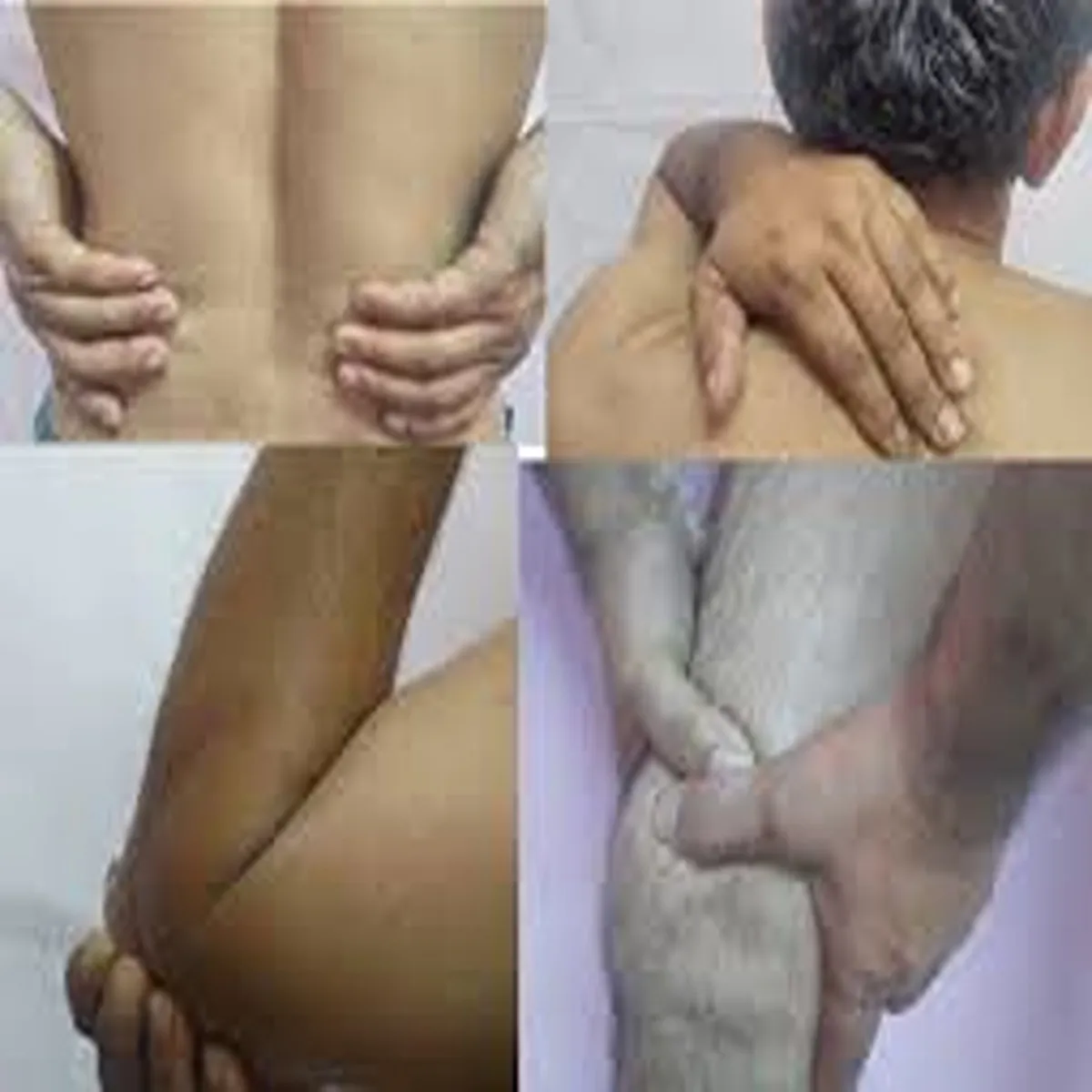 Heatwave rising temperatures linked unexpected joint