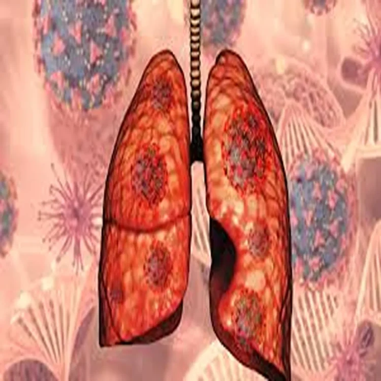 Lung cancer non smokers risk india