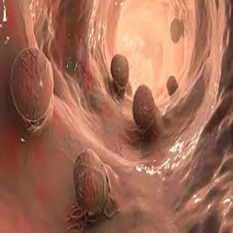 Rising colorectal cancer young adults