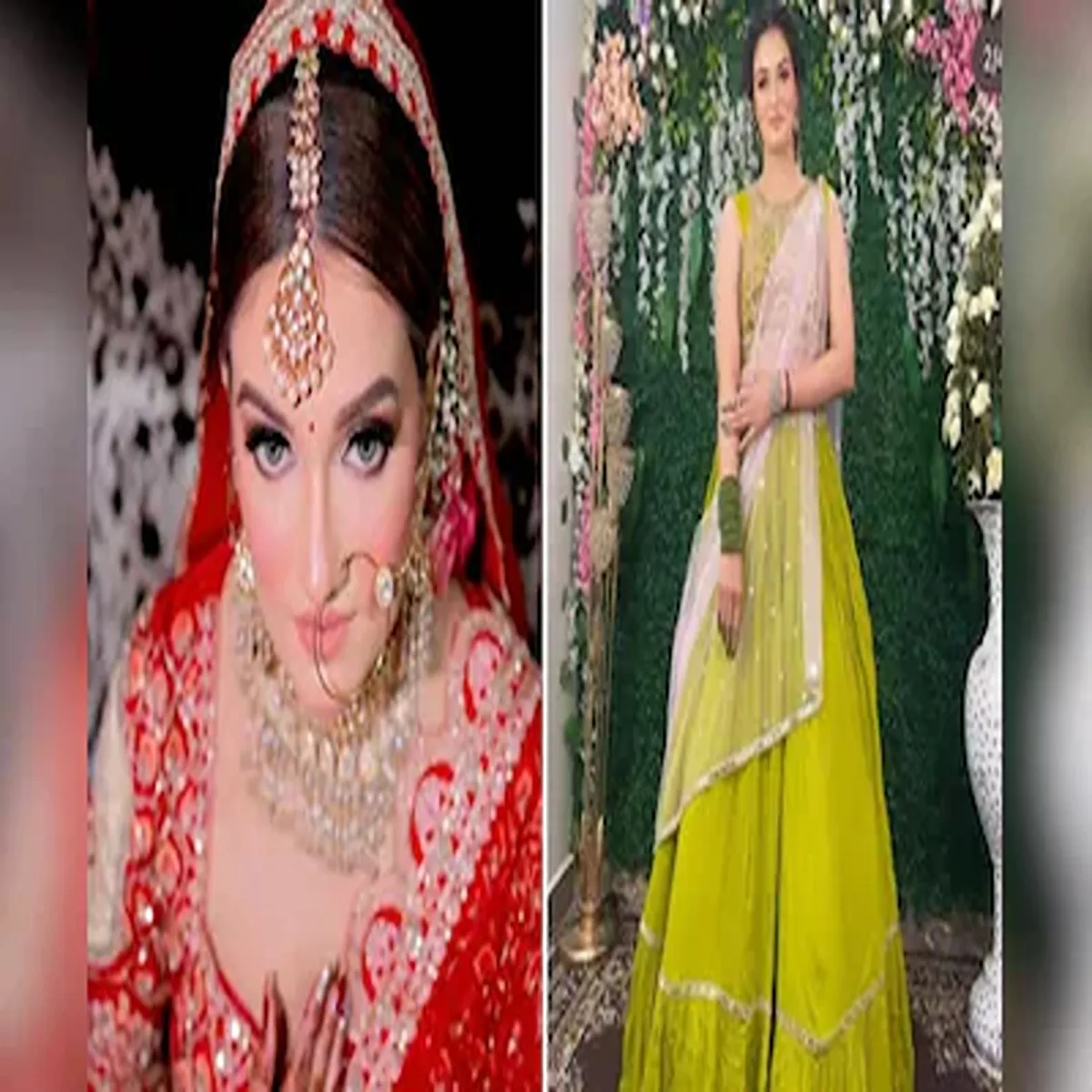 Dowrydeath greater noida woman autopsy reveals