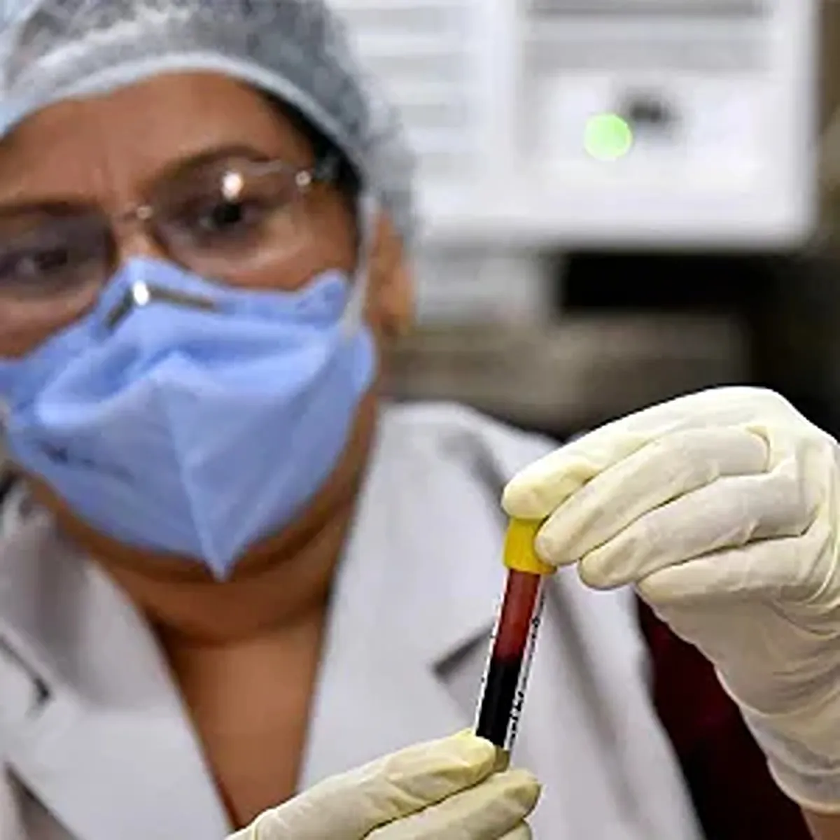 Covid andhra pradesh strengthens health preparedness