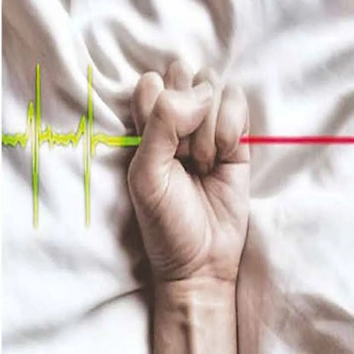 Euthanasia andhra pradesh sets framework passive