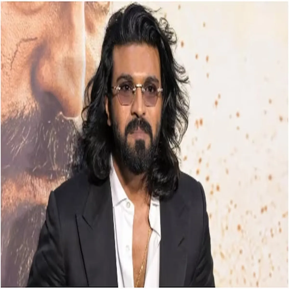 Health update ram charan undergoes successful