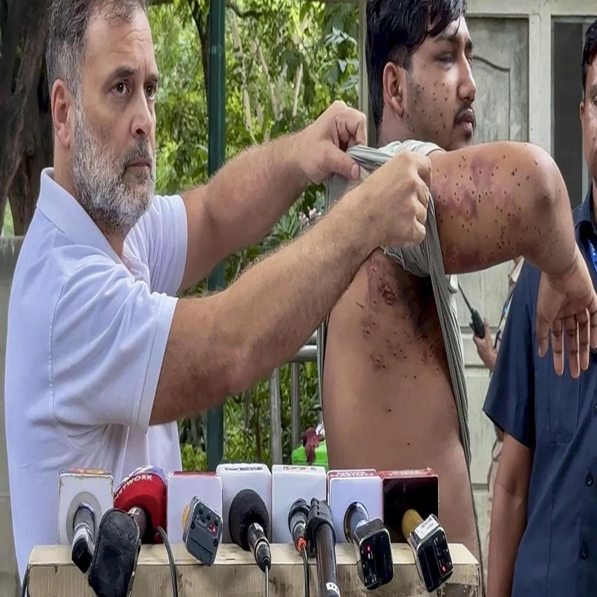 Studentprotest questions intensify over pellet gun